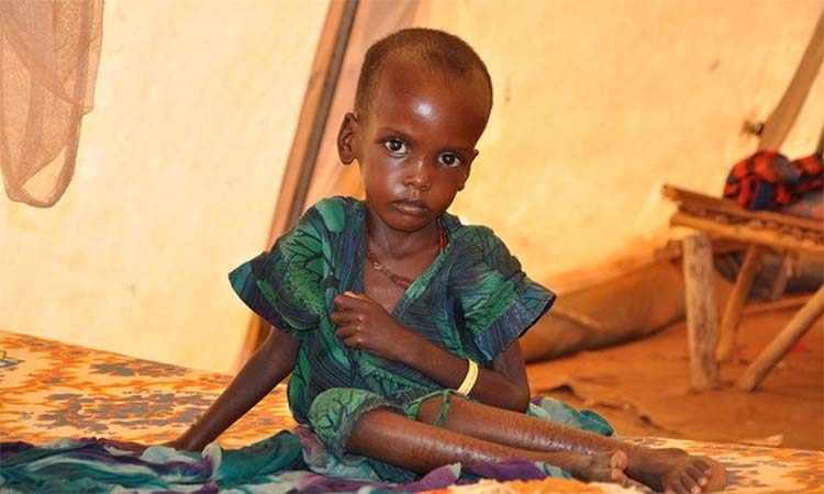 africa,children,malnourished,many,food
