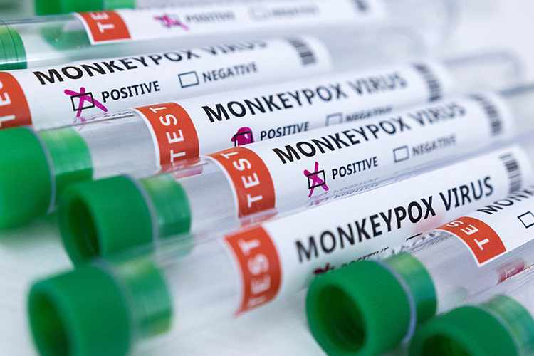 uae,monkeypox,cases,today,health