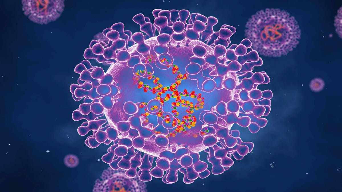 monkeypox dallas rare patient disease