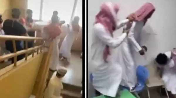 saudi,exchange,student,blows,hospital